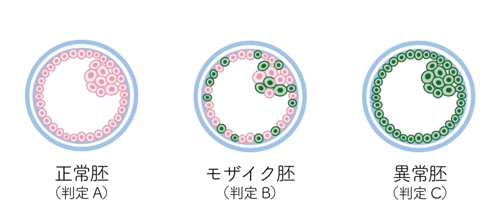 PGTの結果は判定Aの正常胚、判定Bのモザイク胚、判定Cの異常胚に大別される。